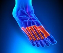 Pain In The Front Of Your Foot